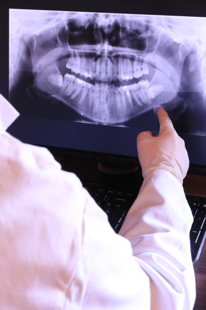 Best Emergency Dental Care for Broken or Chipped Teeth in Crested Butte, CO
