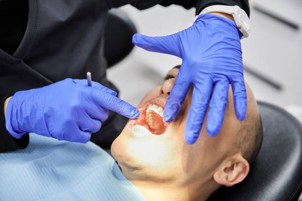 Best Emergency Treatment for Dental Infections or Abscesses in Crested Butte, CO